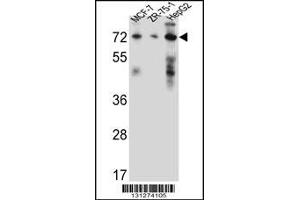 Western blot analysis in MCF-7,ZR-75-1,HepG2 cell line lysates (35ug/lane). (HSD17B4 antibody  (AA 341-370))