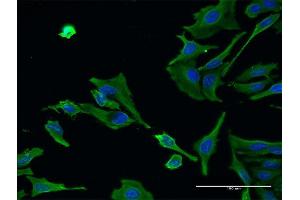 Immunofluorescence of monoclonal antibody to ALS2 on HeLa cell. (ALS2 antibody  (AA 221-320))