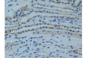 Immunohistochemistry (IHC) image for anti-Tumor Necrosis Factor Receptor Superfamily, Member 1A (TNFRSF1A) (AA 248-428) antibody (ABIN7442288)