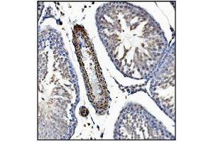 IHC analysis of TAGLN/Transgelin using anti-TAGLN/Transgelin antibody (ABIN7600099). (Transgelin antibody  (AA 15-170))