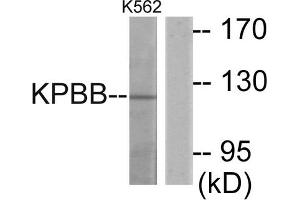 Western blot analysis of extracts from K562 cells, using KPBB antibody.