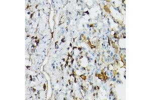 Immunohistochemistry (IHC) image for anti-Toll-Like Receptor 1 (TLR1) (AA 30-290) antibody (ABIN3023655)