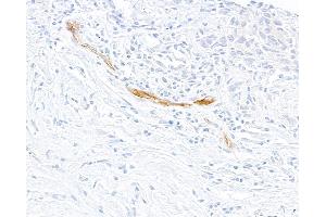 Immunohistochemistry (IHC) image for anti-Selectin E (SELE) (AA 22-555) antibody (ABIN7795699) (Recombinant Selectin E/CD62e antibody  (AA 22-555))