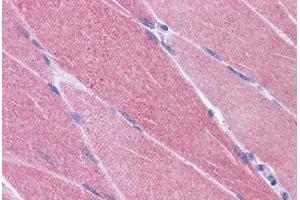 Human Skeletal Muscle: Formalin-Fixed, Paraffin-Embedded (FFPE) (CREB3L1 antibody  (AA 497-509))