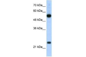 RPL13 antibody used at 2. (RPL13 antibody  (C-Term))