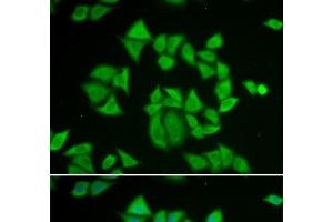 Immunofluorescence analysis of A549 cells using GSTM2 Polyclonal Antibody (GSTM2 antibody)