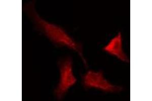 ABIN6275722 staining NIH-3T3 by IF/ICC. (ANKRD20A1 antibody)