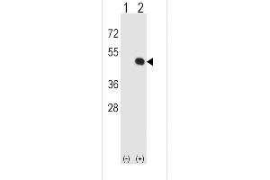 Western blot analysis of HLA-E (arrow) using rabbit polyclonal HLA-E Antibody (Center) (ABIN652456 and ABIN2842310). (HLA-E antibody  (AA 108-135))