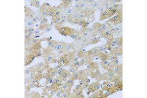 Immunohistochemistry of paraffin-embedded human liver injury using AP1M2 antibody. (AP1m2 antibody  (AA 164-423))