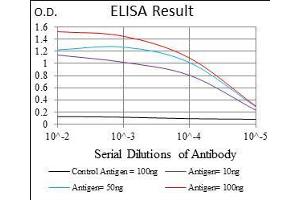 Black line: Control Antigen (100 ng), Purple line: Antigen(10 ng), Blue line: Antigen (50 ng), Red line: Antigen (100 ng), (SLC27A2 antibody  (AA 346-405))