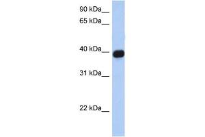 WB Suggested Anti-CXCR6 Antibody Titration:  0.