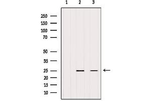 Western Blotting (WB) image for anti-Eukaryotic Translation Initiation Factor 4E (EIF4E) (C-Term) antibody (ABIN6261494)