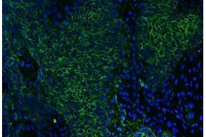 anti-Basigin (Ok Blood Group) (BSG) (AA 138-323) antibody