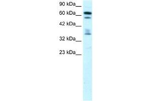 WB Suggested Anti-ZNF512 Antibody Titration: 0. (ZNF512 antibody  (Middle Region))