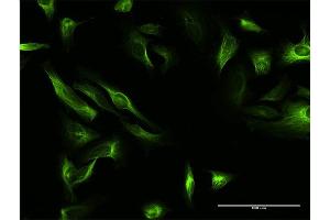 Immunofluorescence of purified MaxPab antibody to MAP7 on HeLa cell. (MAP7 antibody  (AA 1-749))