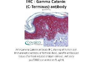 Image no. 1 for anti-Junction Plakoglobin (JUP) (C-Term) antibody (ABIN1734581) (JUP antibody  (C-Term))