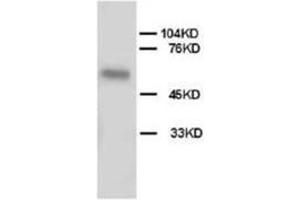 Western blot analysis of Hela cell tissue lysis using ALPL antibody