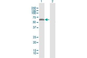 Western Blot analysis of RNF25 expression in transfected 293T cell line by RNF25 MaxPab polyclonal antibody. (RNF25 antibody  (AA 1-459))