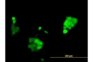 Immunofluorescence of monoclonal antibody to PGR on A-431 cell.