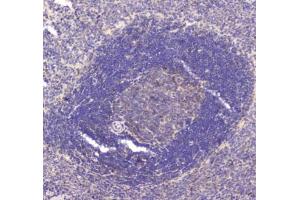 IHC testing of FFPE rat spleen tissue with RAB27A antibody at 1ug/ml. (RAB27A antibody)