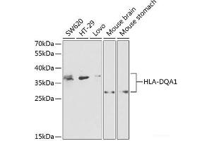 Western blot analysis of extracts of various cell lines using HLA-DQA1 Polyclonal Antibody at dilution of 1:1000. (HLA-DQA1 antibody)