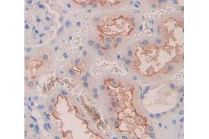 IHC-P analysis of Human Tissue, with DAB staining. (Dysferlin antibody  (AA 1-479))