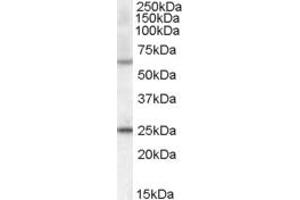 Western Blotting (WB) image for anti-Collagen, Type IV, alpha 3 (Goodpasture Antigen) Binding Protein (COL4A3BP) (AA 662-672) antibody (ABIN293420) (COL4A3BP antibody  (AA 662-672))