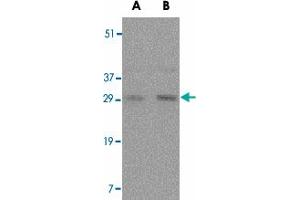 Western blot analysis of TNFSF11 in rat liver tissue lysate with TNFSF11 polyclonal antibody  at (A) 0.