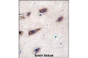 Formalin-fixed and paraffin-embedded human brain tissue reacted with STX3 antibody (Center), which was peroxidase-conjugated to the secondary antibody, followed by DAB staining. (STX3 antibody  (AA 178-205))