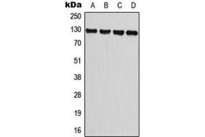 Western blot analysis of TRPM8 expression in A549 (A), PC3 (B), NIH3T3 (C), H9C2 (D) whole cell lysates. (TRPM8 antibody  (Center))