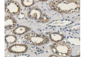 DAB staining on IHC-P; Samples: Human Kidney Tissue (FGF10 antibody  (AA 38-208))