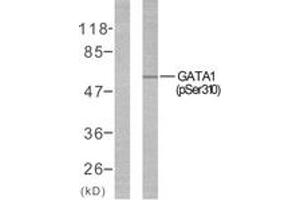 Western blot analysis of extracts from COS7 cells treated with EPO, using GATA1 (Phospho-Ser310) Antibody. (GATA1 antibody  (pSer310))