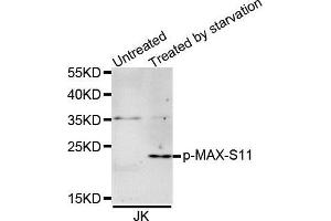 Western Blotting (WB) image for anti-MYC Associated Factor X (MAX) (pSer11) antibody (ABIN3019515) (MAX antibody  (pSer11))