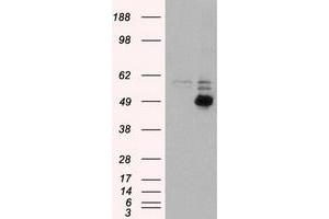 HEK293T cells were transfected with the pCMV6-ENTRY control (Left lane) or pCMV6-ENTRY CD4 (Right lane) cDNA for 48 hrs and lysed. (CD4 antibody)