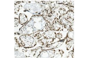 IHC analysis of KAP1/TRIM28 using anti-KAP1/TRIM28 antibody (ABIN7602311).