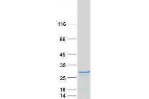 Validation with Western Blot