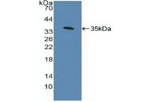 Detection of Recombinant AhR, Human using Polyclonal Antibody to Aryl Hydrocarbon Receptor (AhR) (Aryl Hydrocarbon Receptor antibody  (AA 128-399))