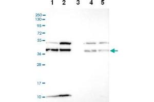 Western blot analysis of Lane 1: RT-4 Lane 2: U-251 MG Lane 3: Human Plasma Lane 4: Liver Lane 5: Tonsil with C6orf47 polyclonal antibody ( Cat # PAB28310) at 1:100-1:250 dilution.