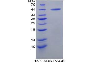SDS-PAGE analysis of Rat Gastrin Protein.