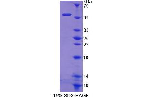 Image no. 1 for Hexokinase 1 (HK1) (AA 413-540) protein (His tag,GST tag) (ABIN4988514)