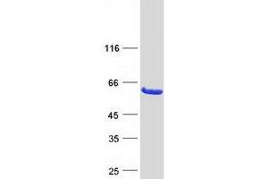 Validation with Western Blot