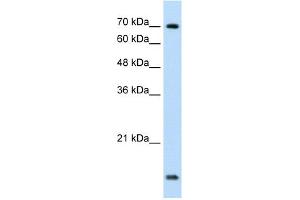 WB Suggested Anti-UBE2L3 Antibody Titration:  1. (UBE2L3 antibody  (C-Term))