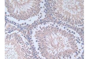 Detection of FN in Rat Testis Tissue using Polyclonal Antibody to Fibronectin (FN) (Fibronectin antibody  (AA 355-558))
