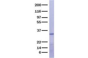 Validation with Western Blot (CPB1 Protein)