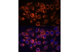 Immunofluorescence analysis of HeLa cells using  antibody (ABIN7265713) at dilution of 1:100. (ATL2 antibody  (AA 390-470))