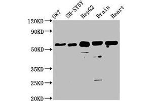 Western Blot Positive WB detected in: U87 whole cell lysate, SH-SY5Y whole cell lysate, HepG2 whole cell lysate, Mouse brain tissue, Rat heart tissue All lanes: CPNE7 antibody at 3. (CPNE7 antibody  (AA 254-393))