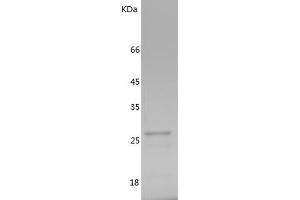 Western Blotting (WB) image for TGF-beta Activated Kinase 1/MAP3K7 Binding Protein 1 (TAB1) (AA 1-200) protein (His tag) (ABIN7281776) (TAB1 Protein (AA 1-200) (His tag))