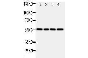 Anti-TXNRD2 antibody, Western blotting Lane 1: Rat Kidney Tissue Lysate Lane 2: Rat Ovary Tissue Lysate Lane 3: Rat Liver Tissue Lysate Lane 4: SMMC Cell Lysate