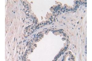 Used in DAB staining on fromalin fixed paraffin-embedded Ovary tissue (CCL27 antibody  (AA 25-112))