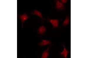 ABIN6267254 staining COS7 by IF/ICC. (ABL1 antibody  (pTyr245))
